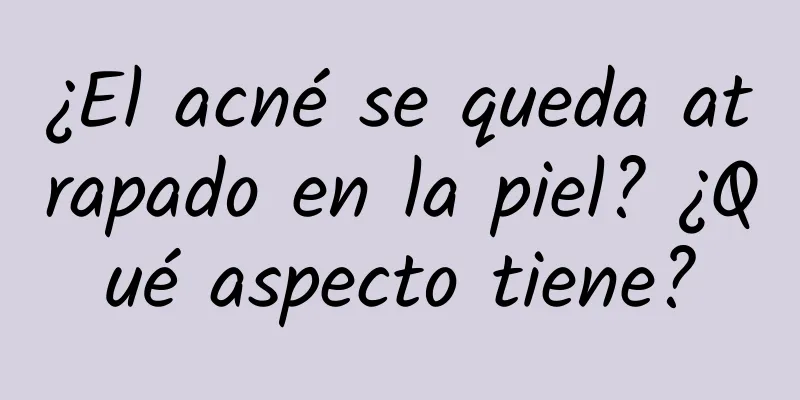 ¿El acné se queda atrapado en la piel? ¿Qué aspecto tiene?